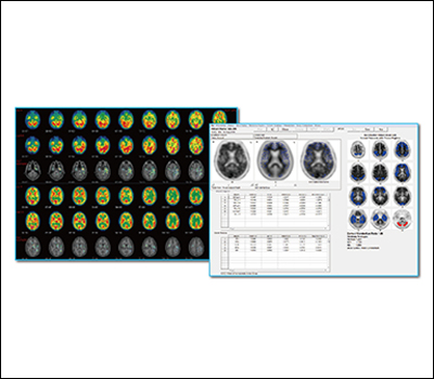 DWS I-NeuroQ Intelligent analysis of cranial nerve system