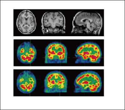 Digital subtraction analysis of cranial nerve images